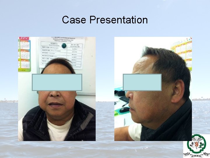 Case Presentation 
