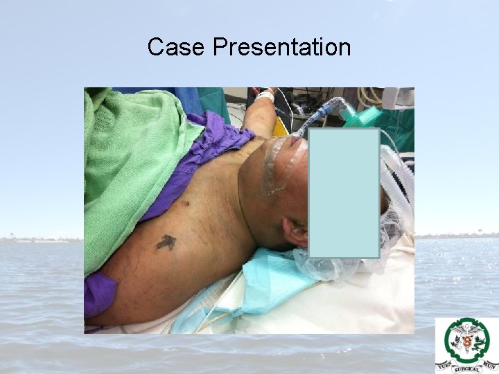 Case Presentation 