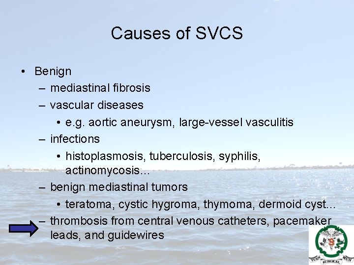 Causes of SVCS • Benign – mediastinal fibrosis – vascular diseases • e. g.