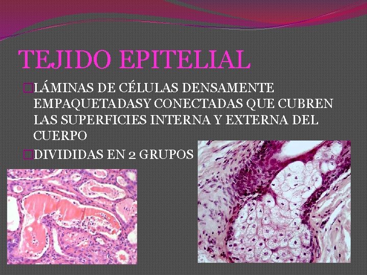 TEJIDO EPITELIAL �LÁMINAS DE CÉLULAS DENSAMENTE EMPAQUETADASY CONECTADAS QUE CUBREN LAS SUPERFICIES INTERNA Y