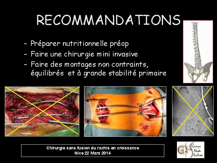 RECOMMANDATIONS – Préparer nutritionnelle préop – Faire une chirurgie mini invasive – Faire des