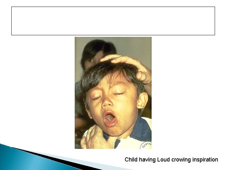 Child having Loud crowing inspiration 