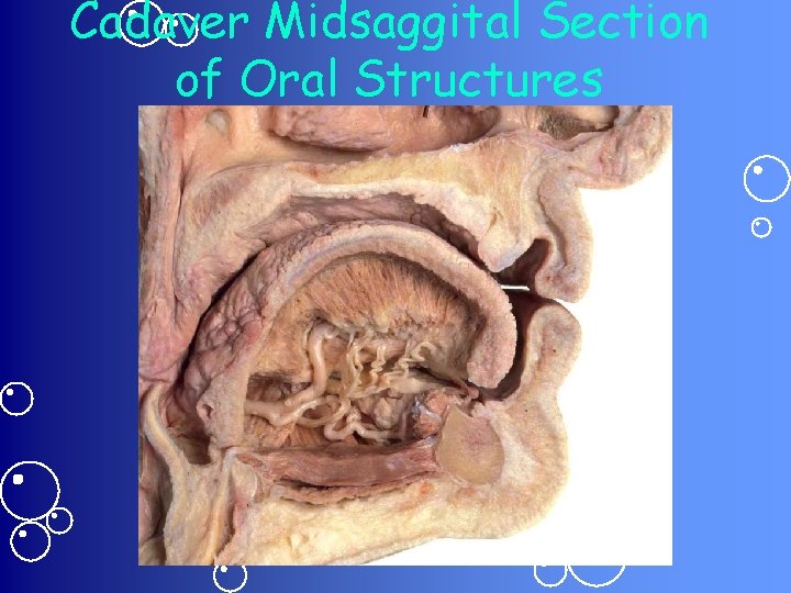 Cadaver Midsaggital Section of Oral Structures 