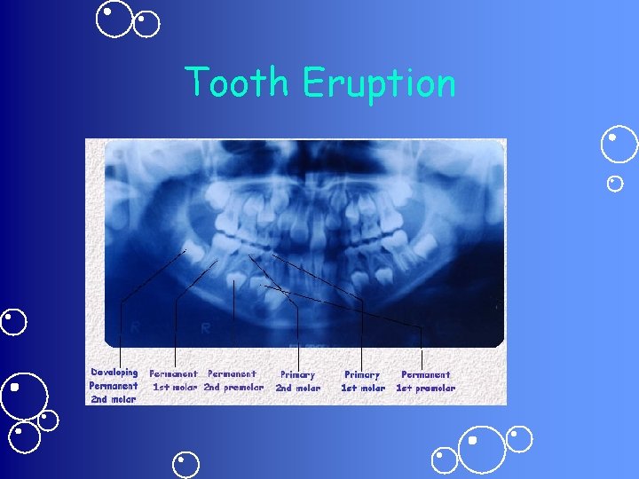 Tooth Eruption 