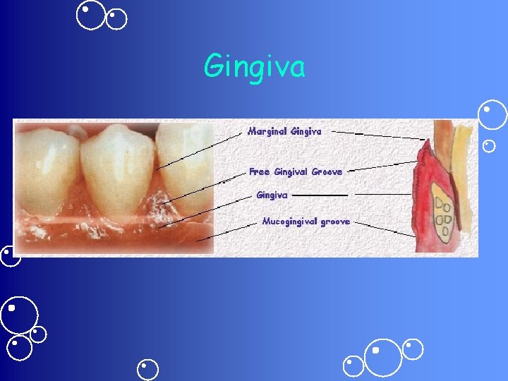 Gingiva 