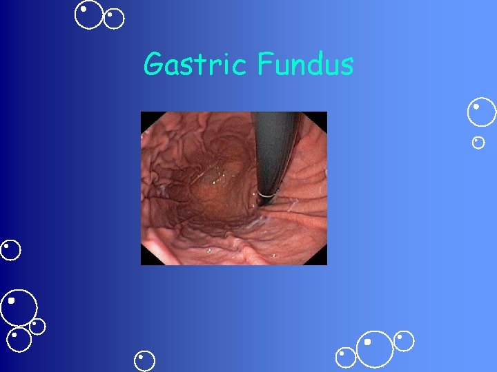 Gastric Fundus 