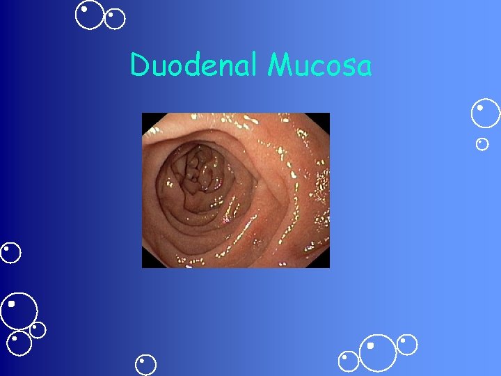 Duodenal Mucosa 