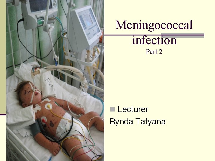 Meningococcal infection Part 2 n Lecturer Bynda Tatyana 