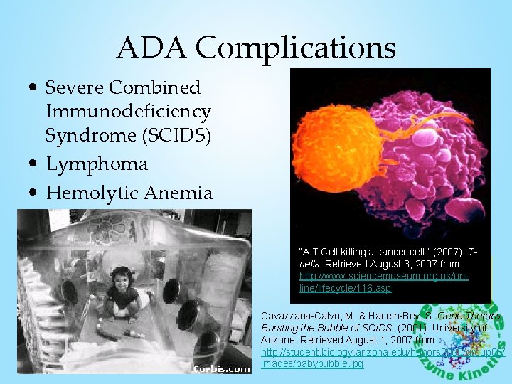 ADA Complications • Severe Combined Immunodeficiency Syndrome (SCIDS) • Lymphoma • Hemolytic Anemia “A