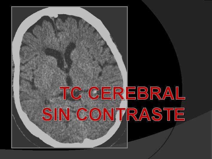 TC CEREBRAL SIN CONTRASTE 