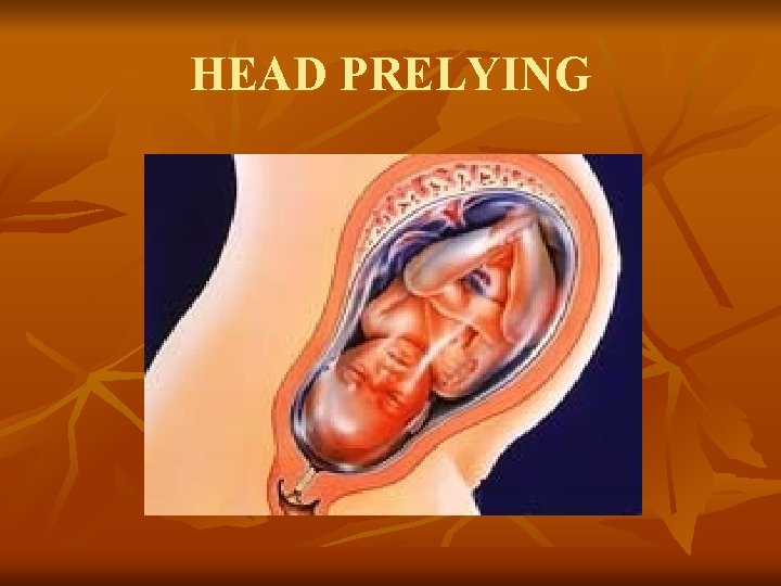 HEAD PRELYING 
