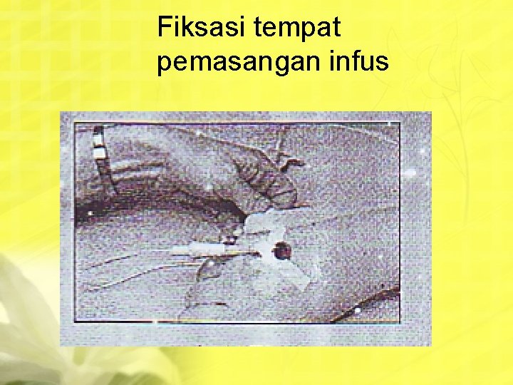 Fiksasi tempat pemasangan infus 