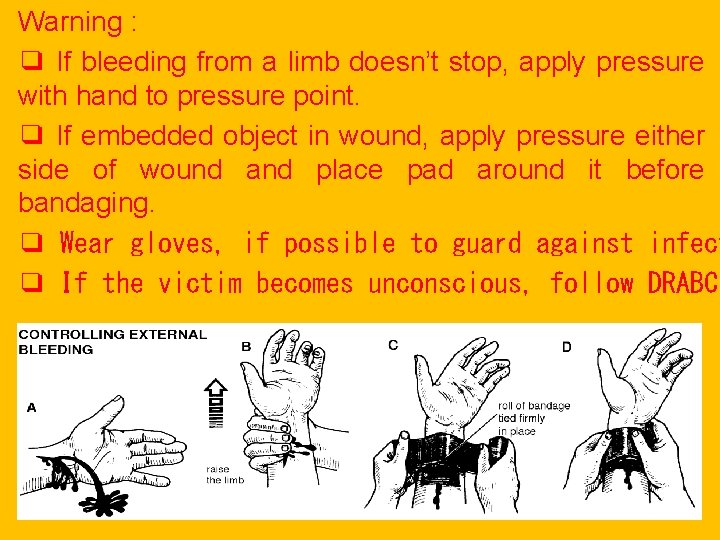 Warning : ❑ If bleeding from a limb doesn’t stop, apply pressure with hand Warning : ❑ If bleeding from a limb doesn’t stop, apply pressure with hand