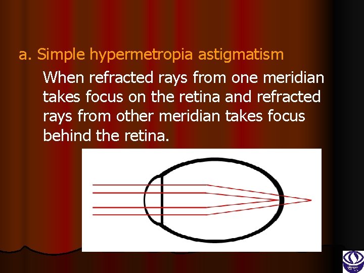 a. Simple hypermetropia astigmatism When refracted rays from one meridian takes focus on the
