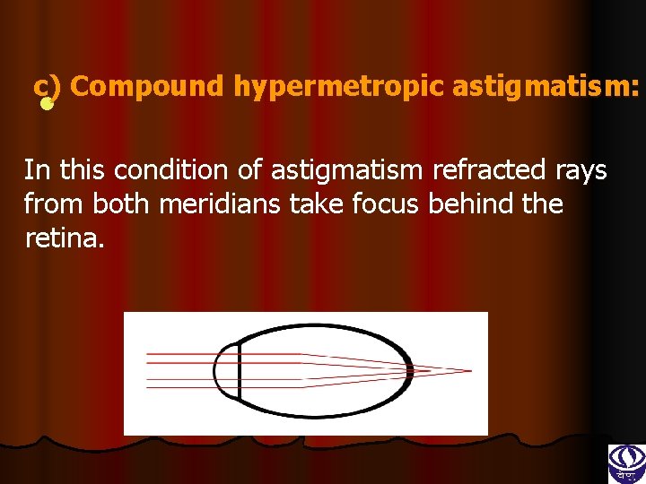 c) Compound hypermetropic astigmatism: l In this condition of astigmatism refracted rays from both