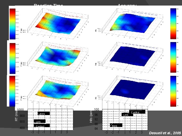 Reaction Time 100% 600 80% Top tom 1000 Bot LEFT Accuracy RHS Righ t