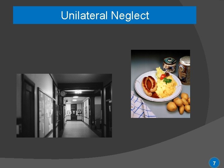 Unilateral Neglect 7 