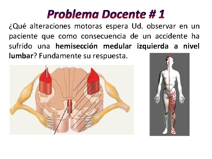 Problema Docente # 1 ¿Qué alteraciones motoras espera Ud. observar en un paciente que Problema Docente # 1 ¿Qué alteraciones motoras espera Ud. observar en un paciente que
