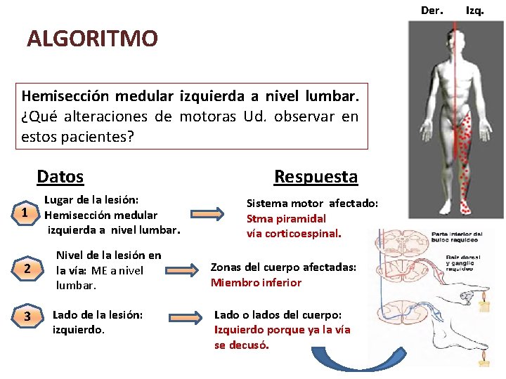 Der. ALGORITMO Hemisección medular izquierda a nivel lumbar. ¿Qué alteraciones de motoras Ud. observar Der. ALGORITMO Hemisección medular izquierda a nivel lumbar. ¿Qué alteraciones de motoras Ud. observar