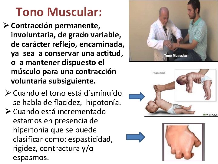 Tono Muscular: Ø Contracción permanente, involuntaria, de grado variable, de carácter reflejo, encaminada, ya Tono Muscular: Ø Contracción permanente, involuntaria, de grado variable, de carácter reflejo, encaminada, ya