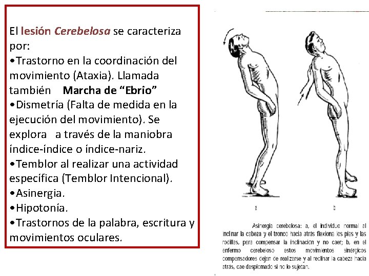 El lesión Cerebelosa se caracteriza por: • Trastorno en la coordinación del movimiento (Ataxia). El lesión Cerebelosa se caracteriza por: • Trastorno en la coordinación del movimiento (Ataxia).