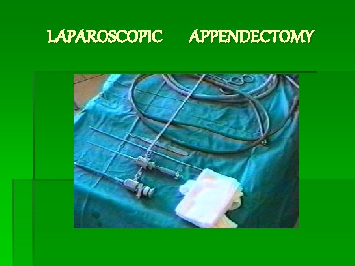 LAPAROSCOPIC APPENDECTOMY 