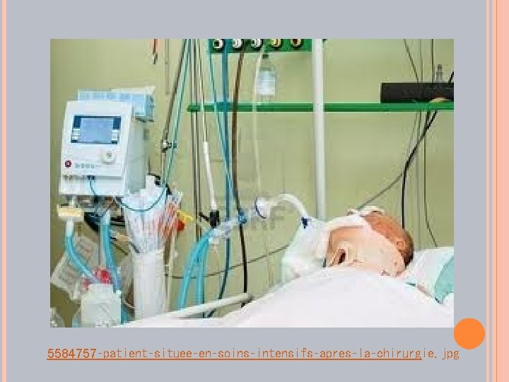 5584757‑patient‑situee‑en‑soins‑intensifs‑apres‑la‑chirurgie. jpg 