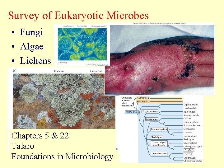 Survey of Eukaryotic Microbes • Fungi • Algae • Lichens Chapters 5 & 22