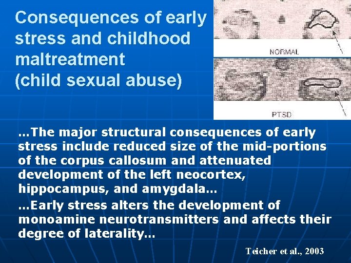 Consequences of early stress and childhood maltreatment (child sexual abuse) …The major structural consequences Consequences of early stress and childhood maltreatment (child sexual abuse) …The major structural consequences
