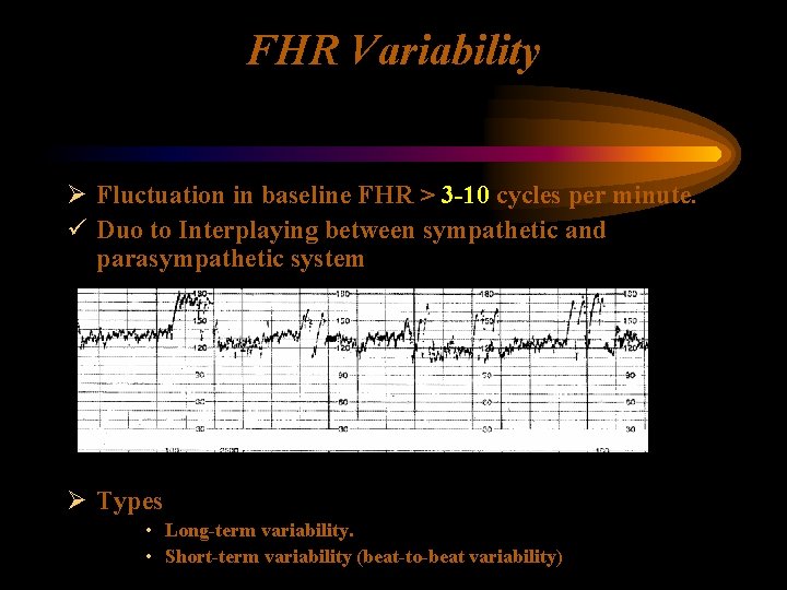 FHR Variability Ø Fluctuation in baseline FHR > 3 -10 cycles per minute. ü