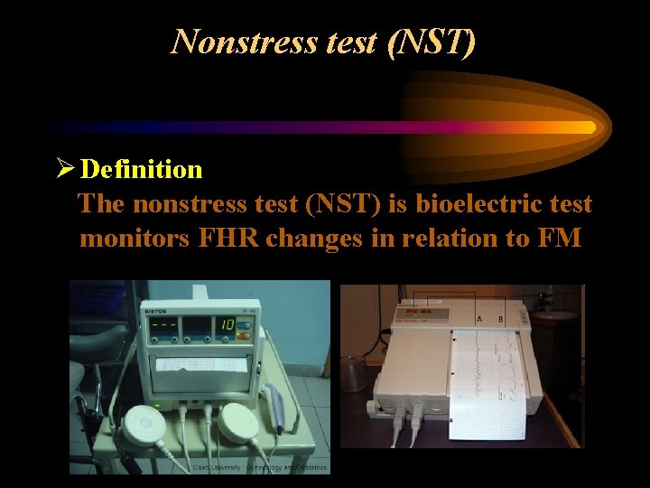 Nonstress test (NST) Ø Definition The nonstress test (NST) is bioelectric test monitors FHR