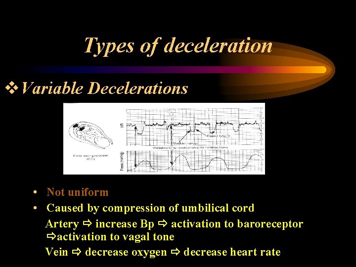 Types of deceleration v. Variable Decelerations • Not uniform • Caused by compression of