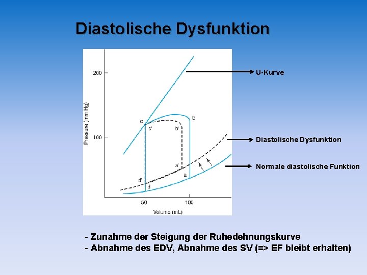 Diastolische Dysfunktion U-Kurve Diastolische Dysfunktion Normale diastolische Funktion - Zunahme der Steigung der Ruhedehnungskurve Diastolische Dysfunktion U-Kurve Diastolische Dysfunktion Normale diastolische Funktion - Zunahme der Steigung der Ruhedehnungskurve