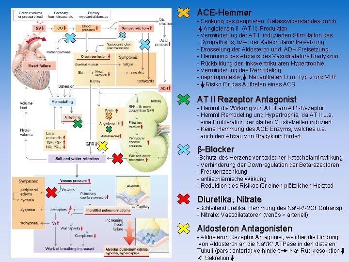 ACE-Hemmer - Senkung des peripheren Gefässwiderstandes durch Angiotensin II (AT II) Produktion - Verminderung ACE-Hemmer - Senkung des peripheren Gefässwiderstandes durch Angiotensin II (AT II) Produktion - Verminderung