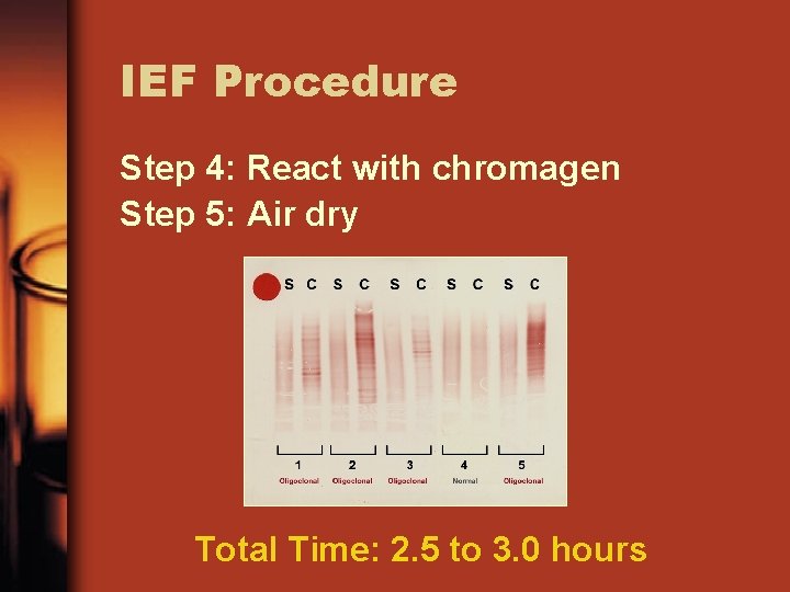 IEF Procedure Step 4: React with chromagen Step 5: Air dry Total Time: 2.