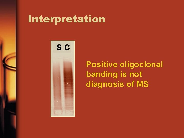 Interpretation Positive oligoclonal banding is not diagnosis of MS 
