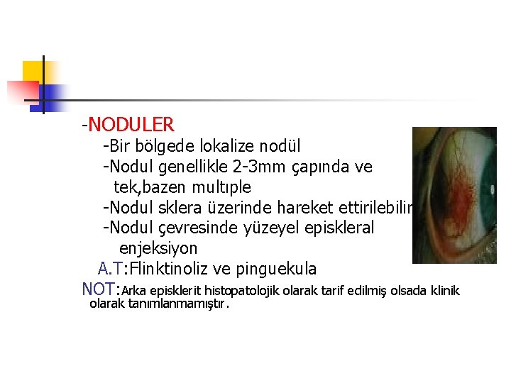 -NODULER -Bir bölgede lokalize nodül -Nodul genellikle 2 -3 mm çapında ve tek, bazen