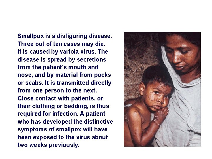 Smallpox is a disfiguring disease. Three out of ten cases may die. It is
