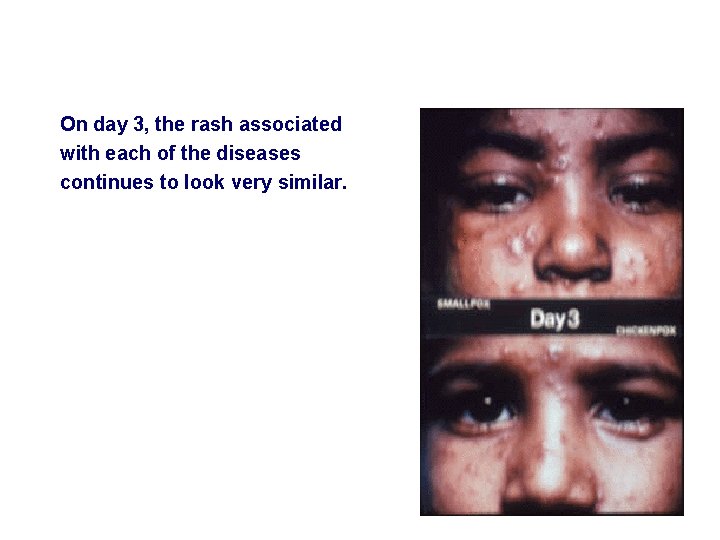 On day 3, the rash associated with each of the diseases continues to look