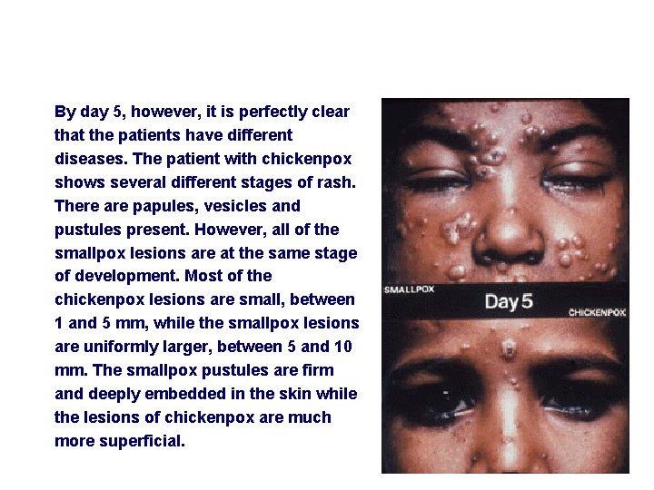 By day 5, however, it is perfectly clear that the patients have different diseases.