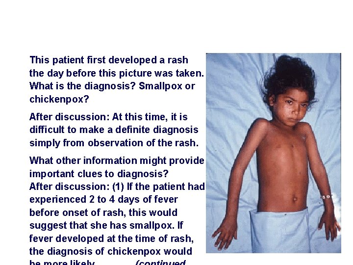 This patient first developed a rash the day before this picture was taken. What