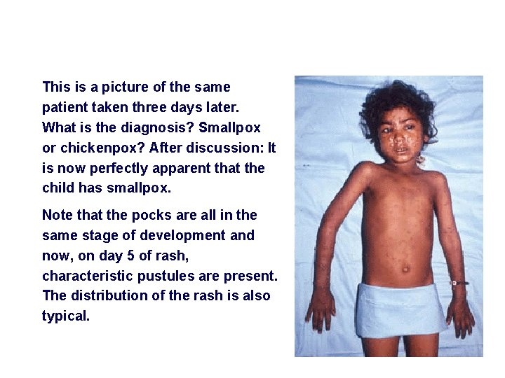 This is a picture of the same patient taken three days later. What is
