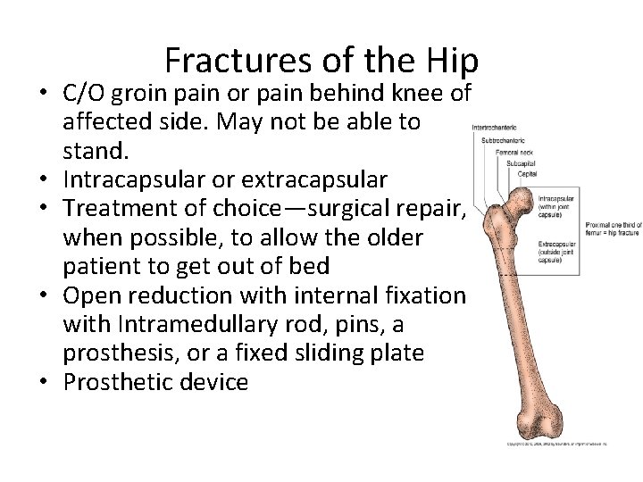 Fractures of the Hip • C/O groin pain or pain behind knee of affected