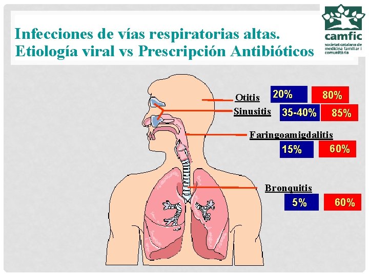 Infecciones de vías respiratorias altas. Etiología viral vs Prescripción Antibióticos 80% Otitis 20% Sinusitis