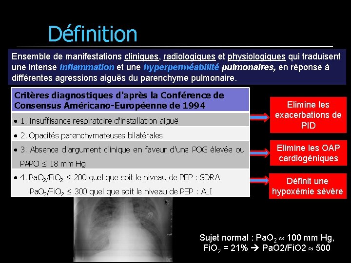 Définition Ensemble de manifestations cliniques, radiologiques et physiologiques qui traduisent une intense inflammation et Définition Ensemble de manifestations cliniques, radiologiques et physiologiques qui traduisent une intense inflammation et
