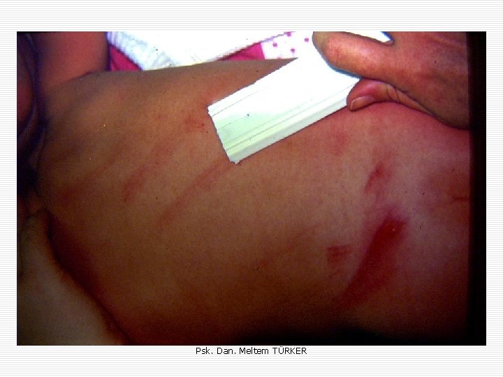 Psk. Dan. Meltem TÜRKER Psk. Dan. Meltem TÜRKER