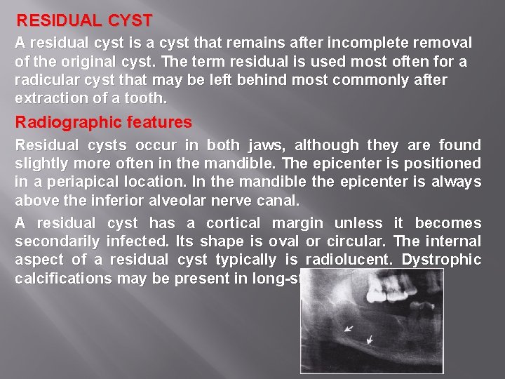 RESIDUAL CYST A residual cyst is a cyst that remains after incomplete removal of