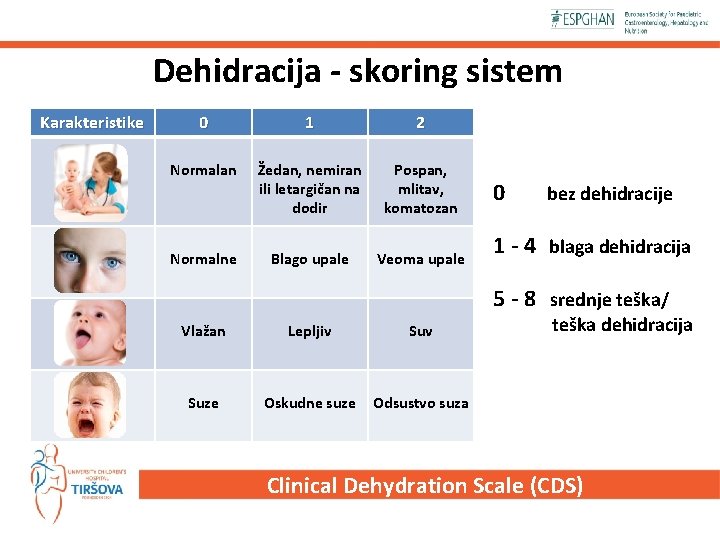 Dehidracija - skoring sistem Karakteristike 0 1 2 Normalan Žedan, nemiran ili letargičan na