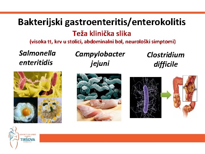 Bakterijski gastroenteritis/enterokolitis Teža klinička slika (visoka tt, krv u stolici, abdominalni bol, neurološki simptomi)