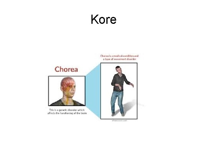 Kore Kore